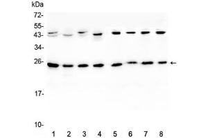 Western blot testing of 1) rat brain, 2) rat lung, 3) mouse brain, 4) mouse lung and human 5) HeLa, 6) placenta, 7) MCF7 and 8) HepG2 lystate with IL36A antibody at 0.