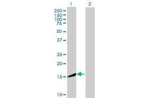 Western Blot analysis of CRYZL1 expression in transfected 293T cell line by CRYZL1 MaxPab polyclonal antibody. (CRYZL1 antibody  (AA 1-113))
