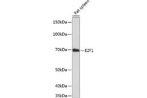 Western blot analysis of extracts of rat spleen, using E2F1 antibody (ABIN7266873) at 1:1000 dilution. (E2F1 antibody)