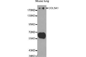 Western blot analysis of extracts of mouse lung, using COL5A1 antibody (ABIN5970709) at 1/500 dilution. (COL5A1 antibody)