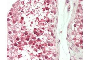 Human Testis: Formalin-Fixed, Paraffin-Embedded (FFPE). (Actin-Like 7A antibody  (FITC))