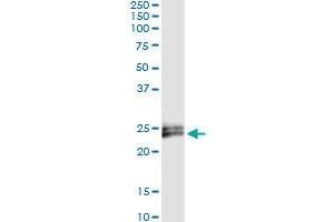 Immunoprecipitation of IFNE transfected lysate using anti-IFNE monoclonal antibody and Protein A Magnetic Bead , and immunoblotted with IFNE MaxPab rabbit polyclonal antibody. (IFNE antibody  (AA 109-208))