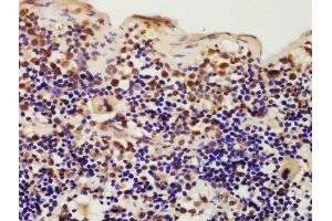 Formalin-fixed and paraffin embedded mouse spleen labeled with Rabbit Anti-IKIP Polyclonal Antibody, Unconjugated (ABIN872858) at 1:200 followed by conjugation to the secondary antibody and DAB staining (IKbIP antibody  (AA 250-350))