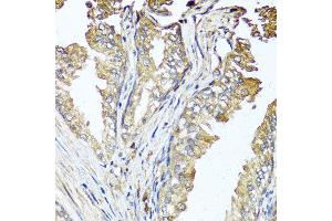 Immunohistochemistry of paraffin-embedded human prostate using STK3 antibody at dilution of 1:100 (x40 lens). (STK3 antibody)
