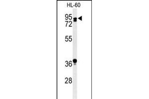 PATL1 antibody  (C-Term)