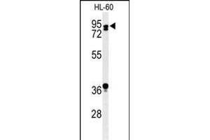 Western blot analysis of TL1 Antibody (C-term) (ABIN653753 and ABIN2843053) in HL-60 cell line lysates (35 μg/lane).