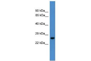WB Suggested Anti-UCHL3 Antibody Titration: 0. (UCHL3 antibody  (C-Term))