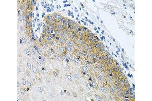 Immunohistochemistry of paraffin-embedded Human esophagus using GNE Polyclonal Antibody at dilution of 1:100 (40x lens). (GNE antibody)