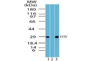 Image no. 1 for anti-Interleukin 1 Receptor-Like 1 (IL1RL1) (AA 207-220) antibody (ABIN960225) (IL1RL1 antibody  (AA 207-220))