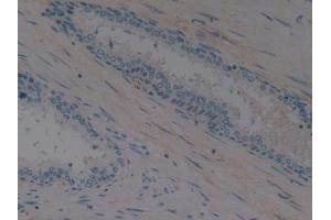 Detection of EPO in Human Prostate Tissue using Polyclonal Antibody to Erythropoietin (EPO) (EPO antibody  (AA 28-193))