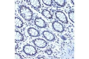 Immunohistochemistry of paraffin-embedded human colon using CDC40 Rabbit mAb (ABIN7266255) at dilution of 1:100 (40x lens).