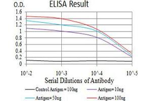 Black line: Control Antigen (100 ng);Purple line: Antigen (10ng); Blue line: Antigen (50 ng); Red line:Antigen (100 ng) (SUZ12 antibody  (AA 1-139))