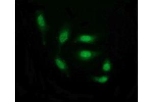 Image no. 6 for anti-THUMP Domain Containing 1 (THUMPD1) antibody (ABIN1501384) (THUMPD1 antibody)