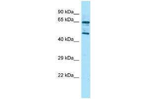 Host: Rabbit Target Name: Rgs14 Sample Type: Mouse Stomach lysates Antibody Dilution: 1.