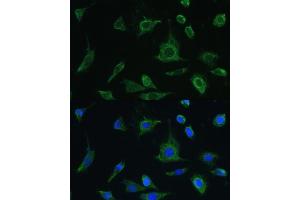 Immunofluorescence analysis of L-929 cells using Oncostatin M antibody (ABIN6128404, ABIN6145072, ABIN6145073 and ABIN6221768) at dilution of 1:100. (Oncostatin M antibody  (AA 26-252))