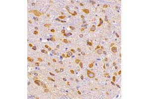 Immunohistochemistry (Paraffin-embedded Sections) (IHC (p)) image for anti-Dihydropyrimidinase-Like 4 (DPYSL4) antibody (ABIN7073734)