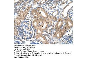 Human kidney (SLC39A6 antibody  (Middle Region))