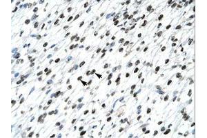 Image no. 3 for anti-Homeobox B9 (HOXB9) (AA 67-116) antibody (ABIN6735813) (HOXB9 antibody  (AA 67-116))