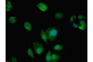 Immunofluorescent analysis of MCF-7 cells using ABIN7144021 at dilution of 1:100 and Alexa Fluor 488-congugated AffiniPure Goat Anti-Rabbit IgG(H+L) (AMPD2 antibody  (AA 1-129))