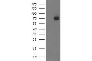 HEK293T cells were transfected with the pCMV6-ENTRY control (Left lane) or pCMV6-ENTRY SH2B3 (Right lane) cDNA for 48 hrs and lysed. (SH2B3 antibody)