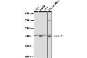 Western blot analysis of extracts of various cell lines, using CYP51 antibody (3485) at 1:1000 dilution. (CYP51A1 antibody  (AA 210-509))