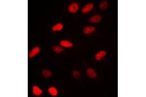 Immunofluorescent analysis of NCOR1 staining in HeLa cells. (NCOR1 antibody  (N-Term))