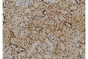 ABIN6277648 at 1/100 staining Rat kidney tissue by IHC-P. (CRYbB2 antibody  (Internal Region))
