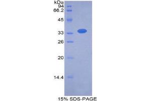 SDS-PAGE (SDS) image for Serpin Family A Member 7 (SERPINA7) (AA 128-415) protein (His tag) (ABIN1525597)