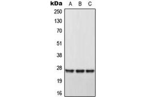 Western blot analysis of DHRS2 expression in HeLa (A), Raw264. (DHRS2 antibody  (Center))