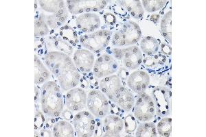 Immunohistochemistry of paraffin-embedded mouse kidney using SSN Rabbit pAb (3377) at dilution of 1:100 (40x lens).