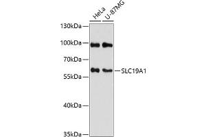 Western blot analysis of extracts of various cell lines, using SLC19 antibody (2819) at 1:3000 dilution. (SLC19A1 antibody  (AA 452-591))