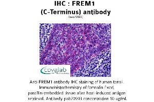 Image no. 1 for anti-FRAS1 Related Extracellular Matrix 1 (FREM1) (C-Term) antibody (ABIN1734463) (FREM1 antibody  (C-Term))