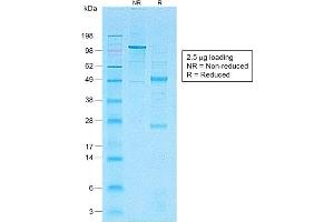 SDS-PAGE Analysis of Purified CD1a-Monospecific RecombinantRabbit Monoclonal Antibody (C1A/1506R).