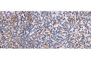 Immunohistochemistry of paraffin-embedded Human tonsil tissue using ITGA11 Polyclonal Antibody at dilution of 1:75(x200) (ITGA11 antibody)