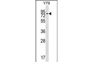 Western blot analysis in Y79 cell line lysates (35ug/lane). (MAK antibody  (C-Term))
