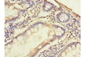 Immunohistochemistry of paraffin-embedded human small intestine tissue using ABIN7169964 at dilution of 1:100 (SLC38A2 antibody  (AA 1-76))