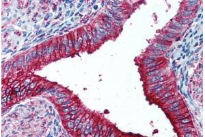 Human Uterus (formalin-fixed, paraffin-embedded) stained with FUT4 antibody ABIN297072 at 1:50 followed by biotinylated anti-mouse IgG secondary antibody ABIN481714, alkaline phosphatase-streptavidin and chromogen. (CD15 antibody)