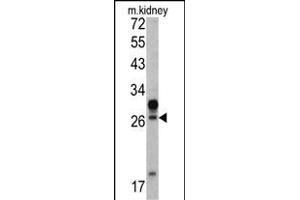 Western blot analysis of HOXA5 antibody (C-term ) (ABIN390648 and ABIN2840947) in mouse kidney tissue lysates (35 μg/lane). (HOXA5 antibody  (C-Term))