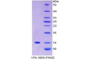 SDS-PAGE analysis of Human AGGF1 Protein.