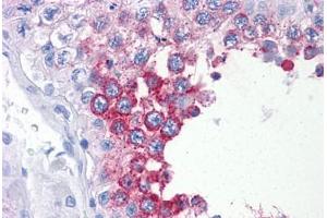 Human Testis: Formalin-Fixed, Paraffin-Embedded (FFPE) (ART3 antibody  (AA 29-139))