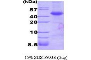 SDS-PAGE (SDS) image for Dystrobrevin Binding Protein 1 (DTNBP1) (AA 1-270) protein (His tag) (ABIN667731)
