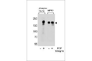 Western blot analysis of extracts from A431 cells,untreated or treated with EGF,100 ng/mL,using phospho HER2- (left) or HER2 Antibody (right) (ErbB2/Her2 antibody  (pTyr1112))