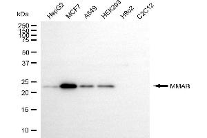 Western blotting analysis using MMAB antibody (ABIN7799394).