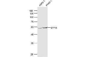 Lane 1: ASPC-1 lysates Lane 2: PANC-1 lysates probed with ZFP14 Polyclonal Antibody, Unconjugated  at 1:300 dilution and 4˚C overnight incubation.