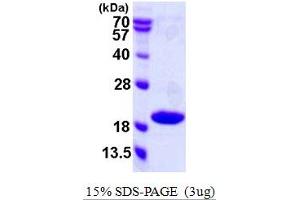 SDS-PAGE (SDS) image for Cyclin-Dependent Kinase Inhibitor 2C (p18, Inhibits CDK4) (CDKN2C) (AA 1-168) protein (His tag) (ABIN667655) (CDKN2C Protein (AA 1-168) (His tag))