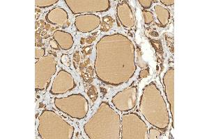 IHC analysis of Citrin/SLC25A13 using anti-Citrin/SLC25A13 antibody (ABIN7599512). (slc25a13 antibody  (AA 1-643))