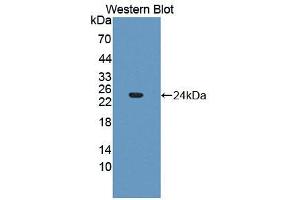 Figure. (FGF21 antibody  (AA 29-209))