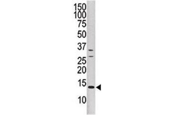 DUSP15 antibody  (AA 17-44)