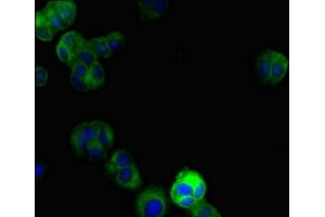 Immunofluorescent analysis of MCF-7 cells using ABIN7150145 at dilution of 1:100 and Alexa Fluor 488-congugated AffiniPure Goat Anti-Rabbit IgG(H+L) (DRAM2 antibody  (AA 182-266))