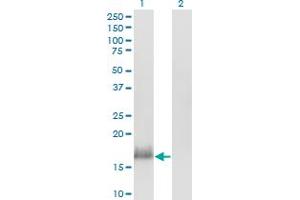 Image no. 1 for anti-Calmodulin Like Protein 3 (CALML3) (AA 1-150) antibody (ABIN465938) (CALML3 antibody  (AA 1-150))